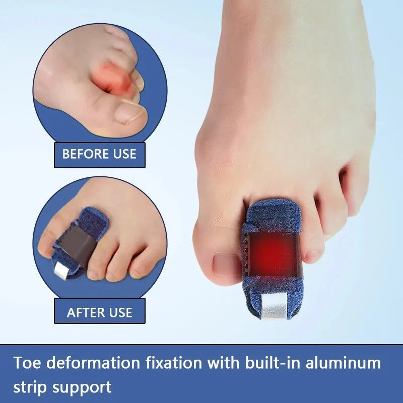 1pcs Toe Splint Toe Straightener For Hammer Toe Brace Hammertoe Splint
